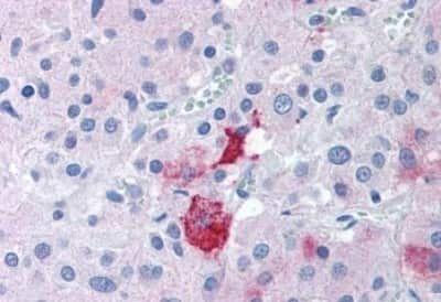 Immunohistochemistry-Paraffin: EPHX2 Antibody [NBP3-14312] - Immunohistochemistry of formalin-fixed, paraffin-embedded human adrenal after heat-induced antigen retrieval.